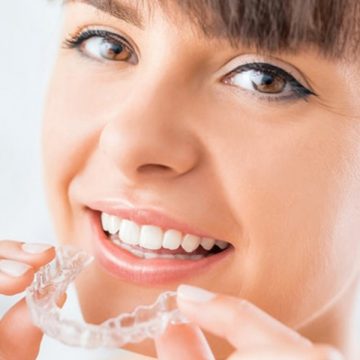 6 Teeth Imperfections Invisalign® Can Fix