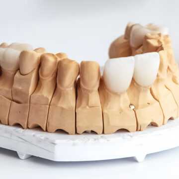 Maintaining Your Veneers Made Straightforward