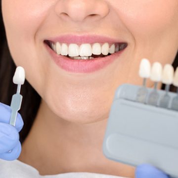 Are Veneers a Solid Alternative to Braces?