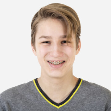 Got Bite Problems? Braces Can Fix Them
