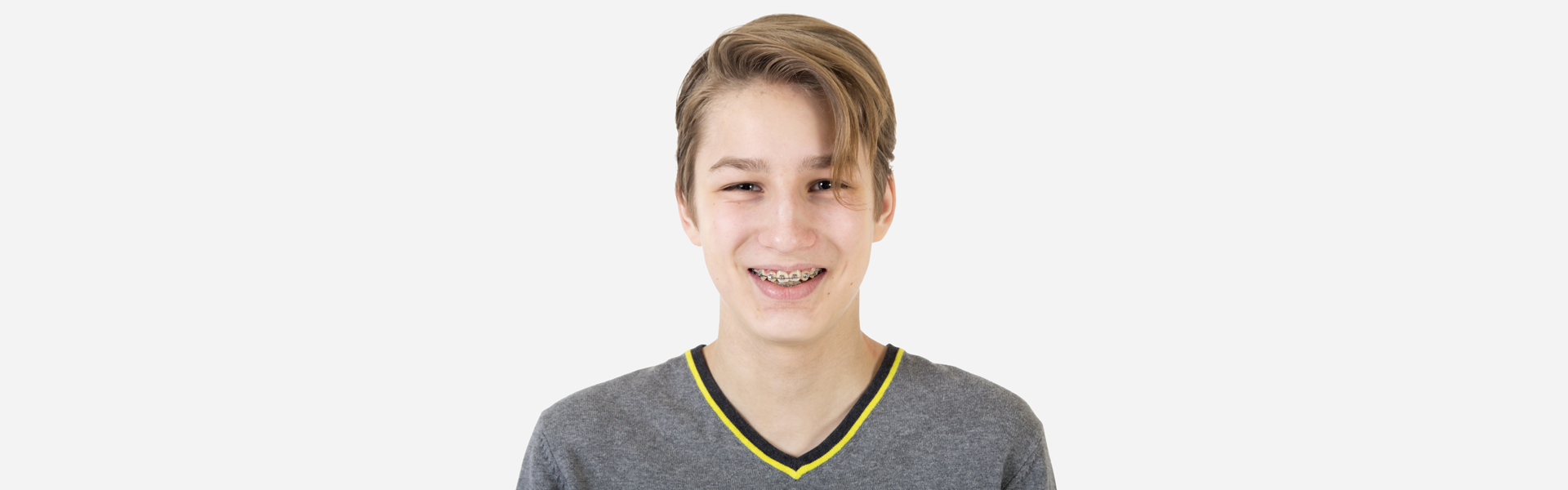 Got Bite Problems? Braces Can Fix Them