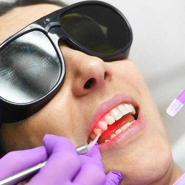 What to Expect During an Air Abrasion Treatment at Your Dentist