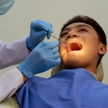 Tooth Extraction and Infection: Can It Happen Again?