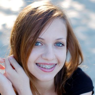 How Can You Maintain Results After Orthodontic Treatment?